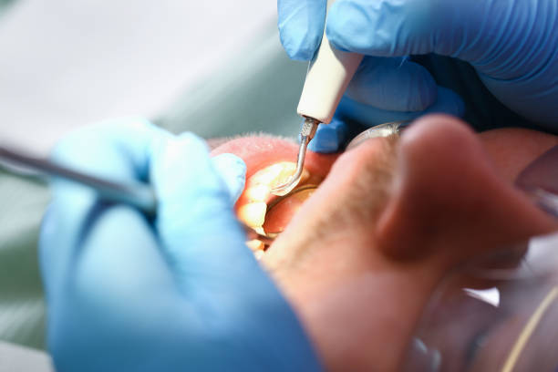 Best Emergency Dental Care for Sports Injuries in Lyons, GA
