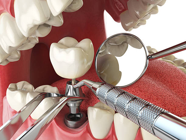 Best Emergency Denture Repair in Lyons, GA